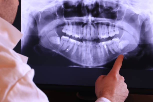Reliable MD Emergency Dental Service Solutions